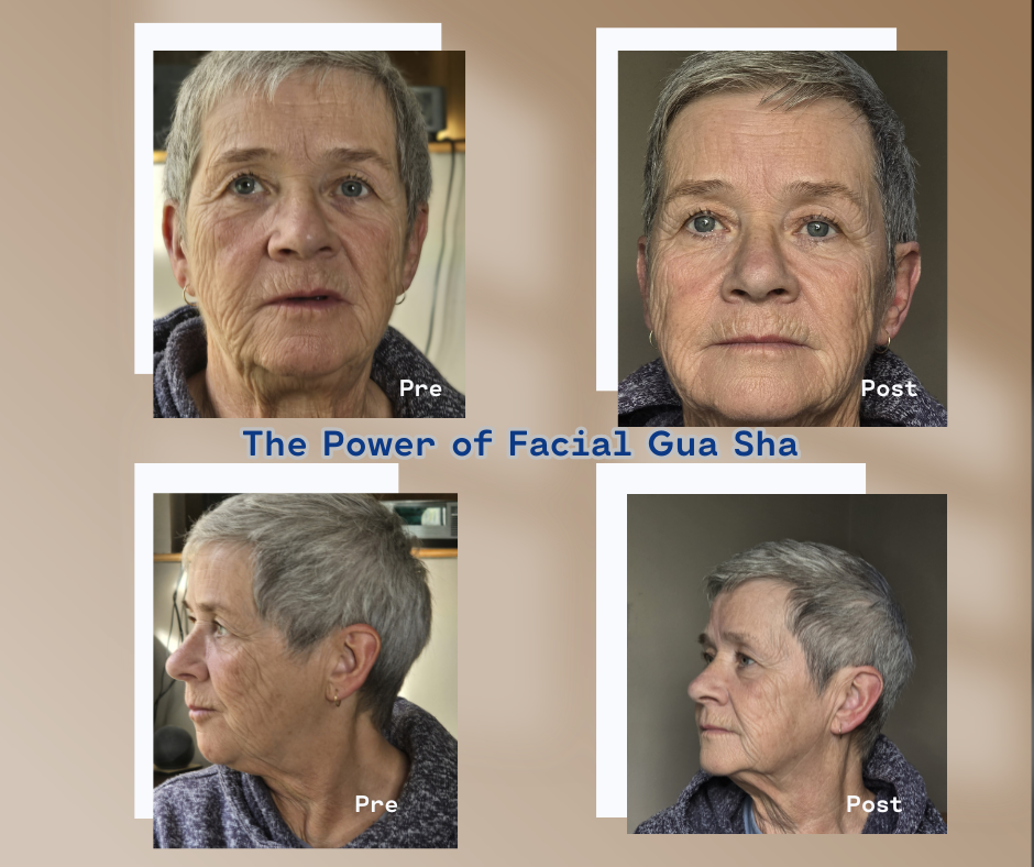 The before and after images of facial Gua Sha